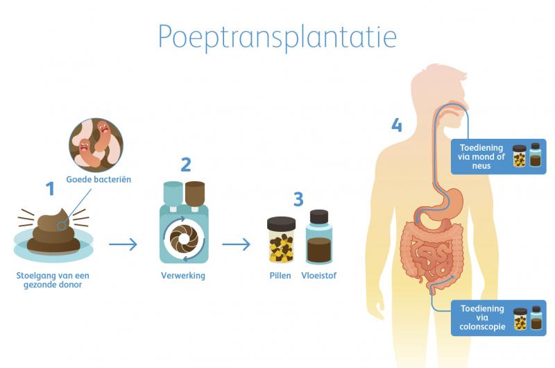 Hoe Vaak Zou Je Eigenlijk Moeten Poepen? | Pfizer